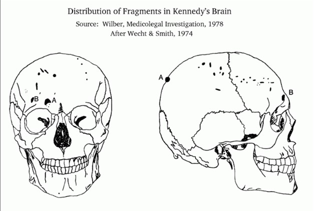 skull fragments