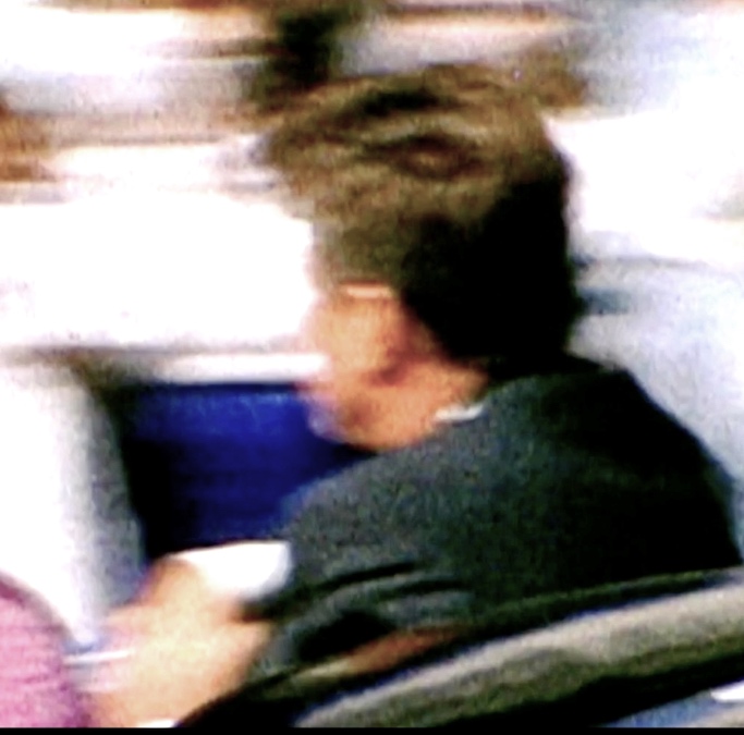 Figure 10. JFK&rsquo;s face appears anomalous. Also note a sharp posterior head shadow. (Source: George Jeffries, The Sixth Floor Museum)