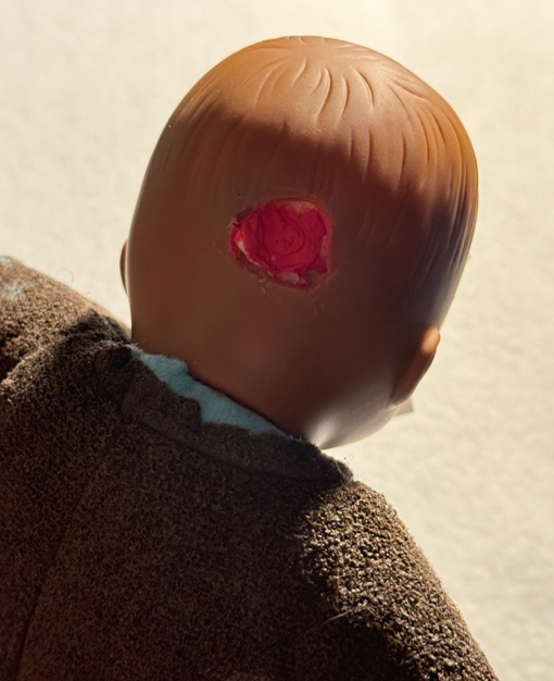 Figure 16. Mock head wound in a doll. (Source: Photo by author)