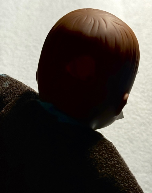 Figure 17. Same head wound at a darker exposure shows how easy it is to cloak the wound. (Source: Photo by author)
