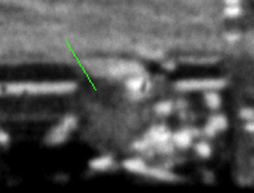 Figure 26. Connally shown in a crop of Frame 317 from the unnamed analyst’s slide in Figure 22. The windowsill and two shaded areas of grass are heavily obscured by the overlaid line and the high-cont...