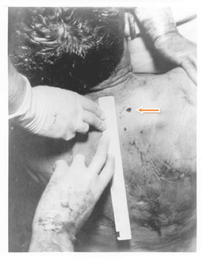 http://i217.photobucket.com/albums/cc151/David_Von_Pein/MISCELLANEOUS%20JFK-RELATED%20PHOTOS/JFK_Autopsy_Photo_3.jpg?t=1278230684