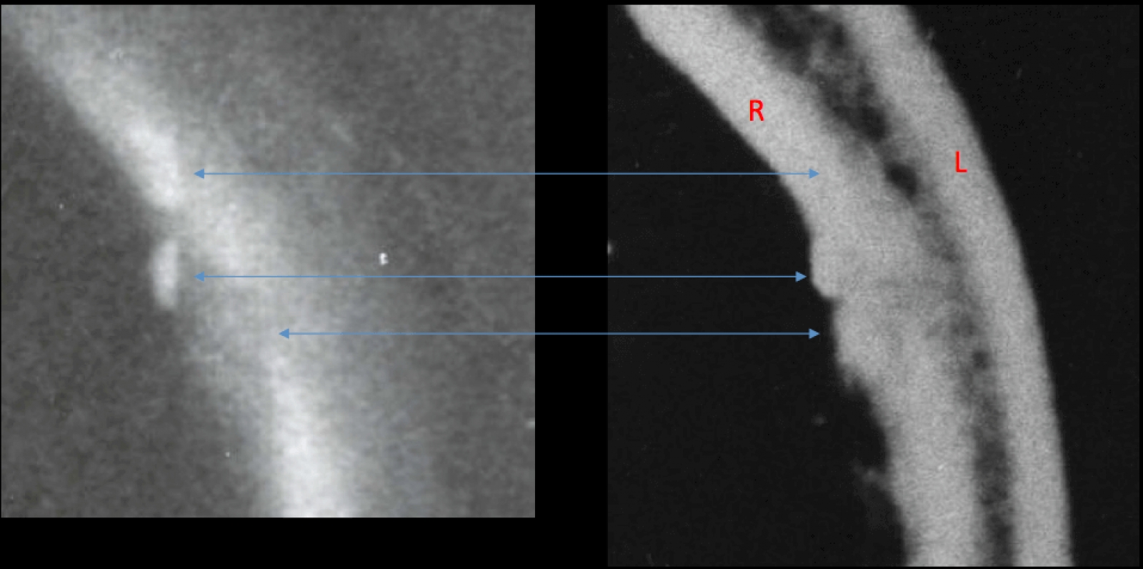 The Application of Forensic Principles for the Analysis of  the Autopsy Skull X-Rays of President Kennedy and a Review of the Brain Photographs